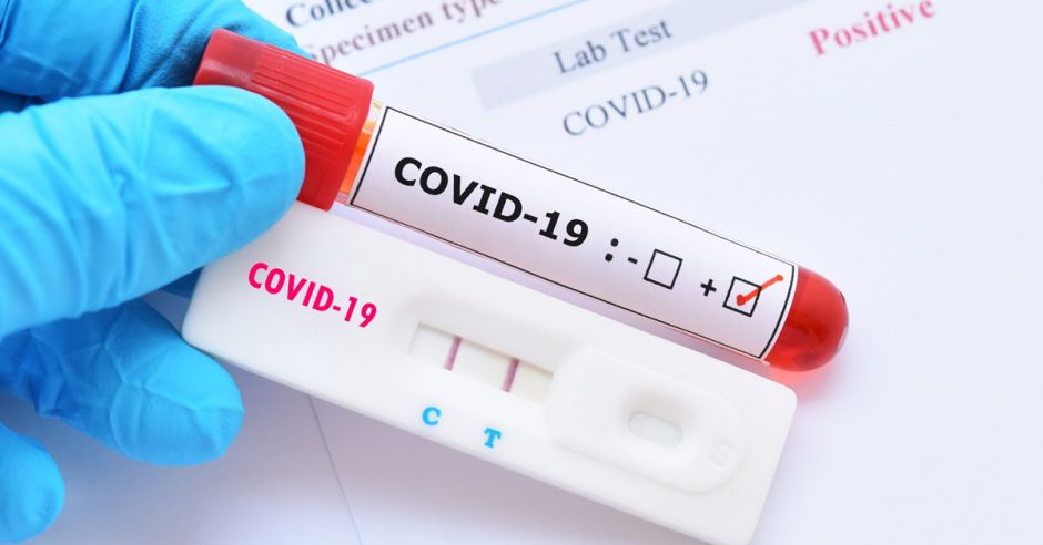 Covid en Alta Gracia: el fin de semana cerró con 131 nuevos casos y una muerte