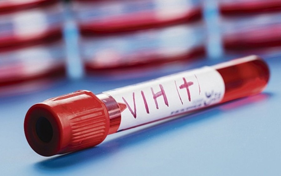 Por primera vez una vacuna contra el VIH alcanza la fase 3