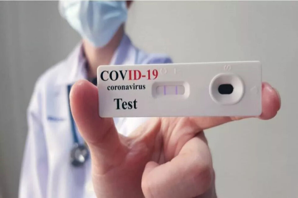 Los primeros autotests de Covid estarán disponibles en farmacias a 1.560 pesos