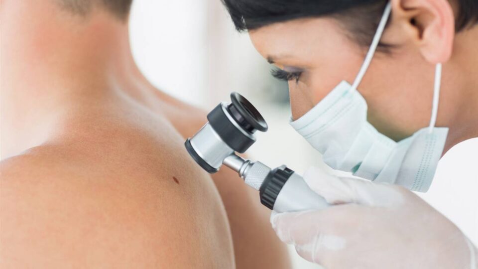 El próximo jueves 15 realizarán una jornada de prevención del cáncer de piel