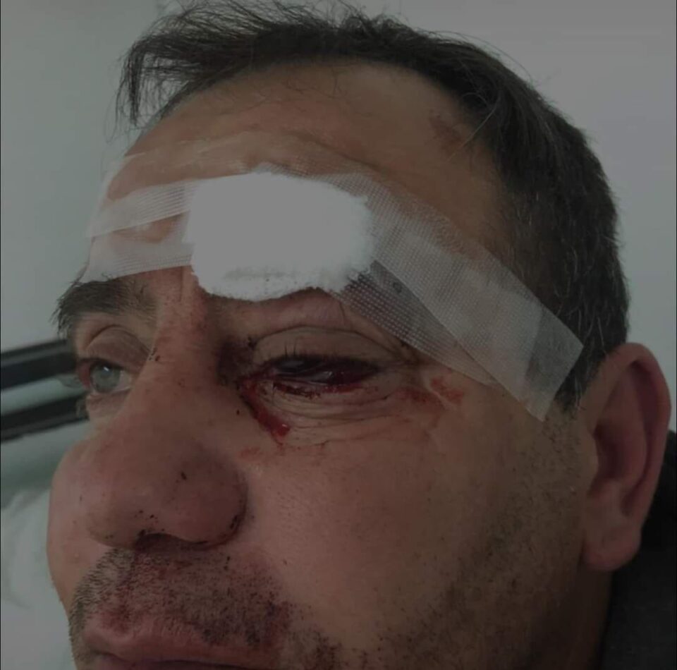 Un fletero sufrió una brutal golpiza en Barrio Córdoba: está al borde de perder la vista