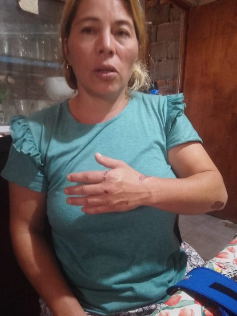 Vecina de La Donosa sufrió un accidente y su familia pide ayuda para su recuperación