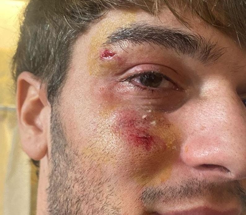 Le arrojaron piedras desde un baldío y lo hirieron en la cara
