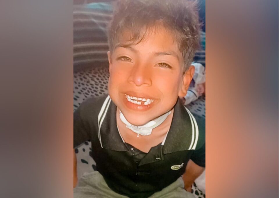 Todos por Yoni: su familia impulsa un evento solidario para costear su cirugía