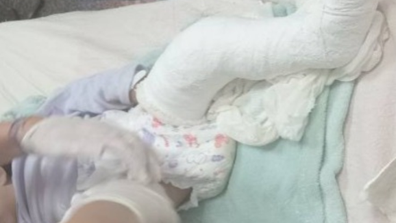 Pericias confirmaron fracturas intencionales en una bebé de dos años