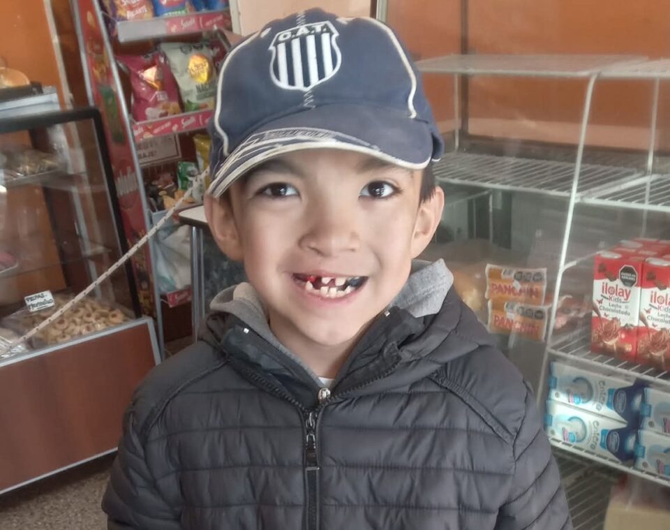 Buscan vender 100 pizzas para costear los estudios médicos de un niño de Falda del Carmen